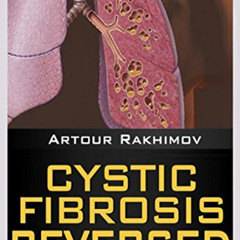Get EPUB 📥 Cystic Fibrosis Life Expectancy: 30, 50, 70… (Health, Fitness and Dieting