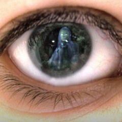 Eye - anomaly