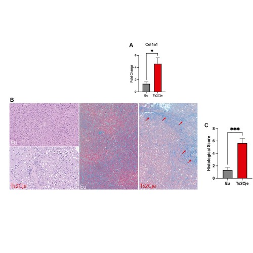 Aging Exacerbates Oxidative Stress and Liver Fibrosis in an Animal Model of Down Syndrome