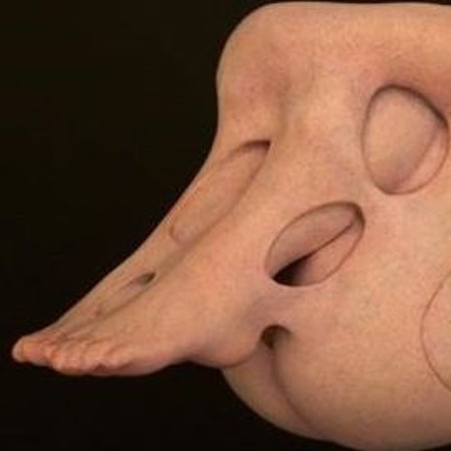 Chiasme — blessed with agnosia