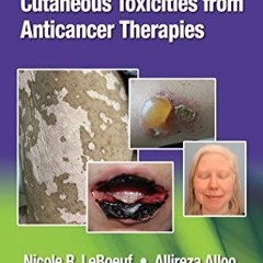 PDF KINDLE DOWNLOAD Cutaneous Toxicities from Anticancer Therapies android