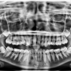 when the lights go off