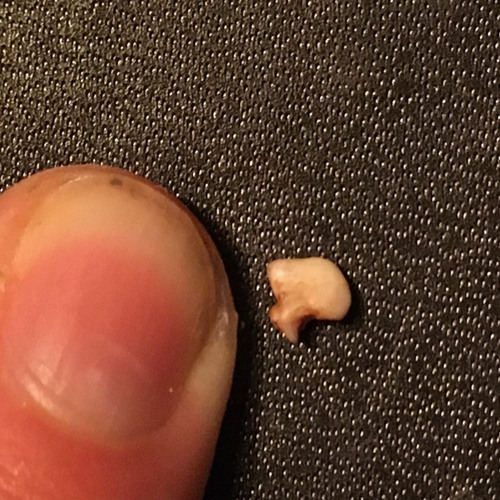 Ear Tooth