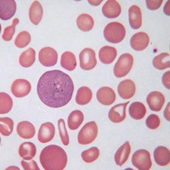 Polychromasia