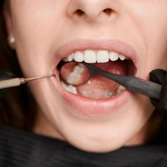 Effective Gum Disease Treatment: Tips from Coastal Smiles Family Dentistry