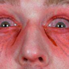 Best Pepper Spray In The Eyes Treatment Reviews