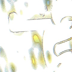 zaebla)) (prod. erdo)