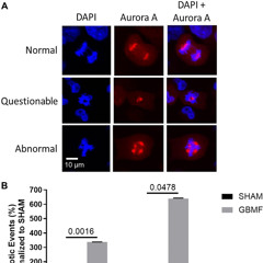 New Radiofrequency Therapy Slows Glioblastoma Growth and Targets Tumor Stem Cells