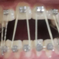 StomachBleed (Prod Belsha)