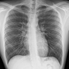 not enough prod jexelout