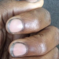 Dirty Nails