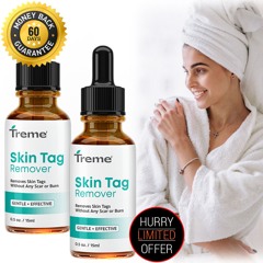 Treme Skin Tag Remover (USA Sale) Remove All Types Of Moles, Warts, Skin Tags