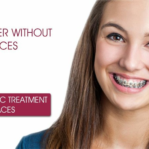 Stream episode Best Braces For Teeth In Noida by Ratra Dental Center