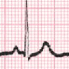 Review Intro To Dysrhythmia