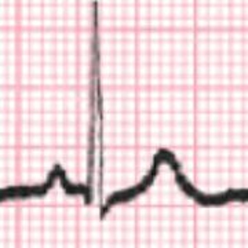 Review Intro To Dysrhythmia