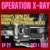 Artwork for OPERATION XRAY EP 27 - Oct 1, 2021