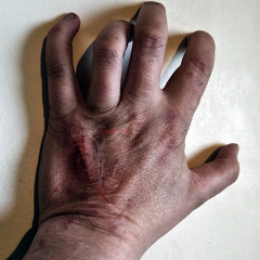 The Hurt
