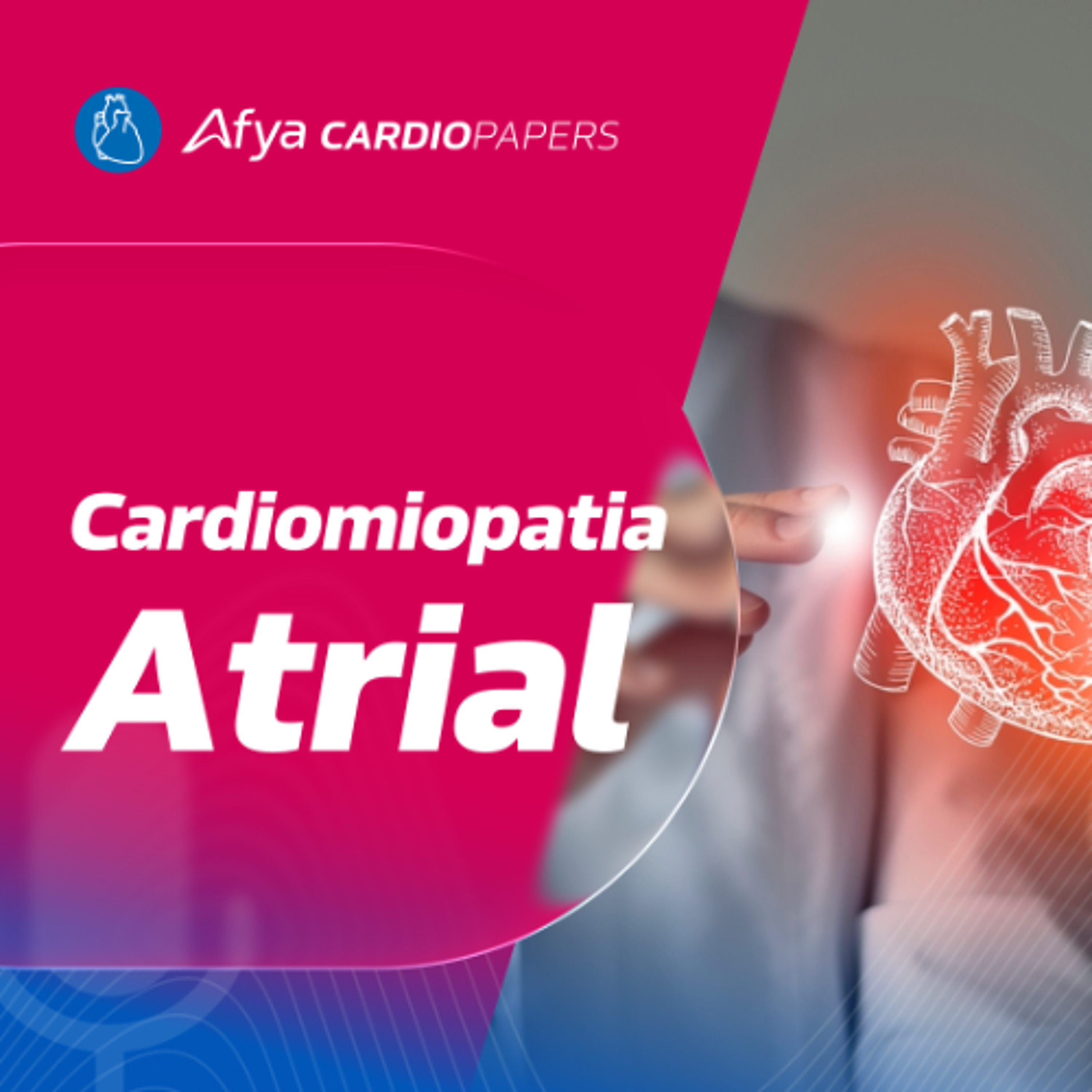 Cardiomiopatia Atrial