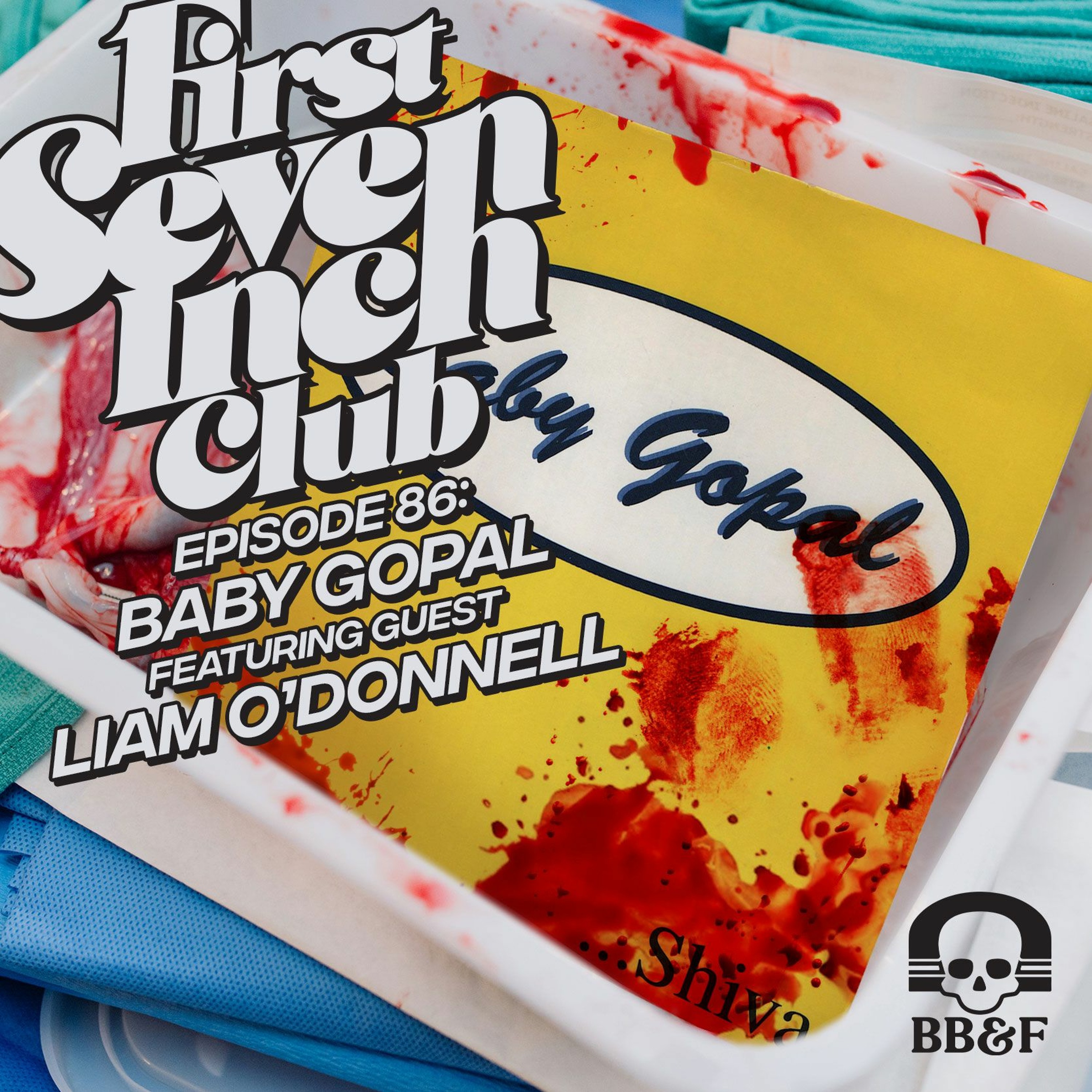 Episode 86 - Baby Gopal - Featuring Guest Liam O'Donnell episode artwork