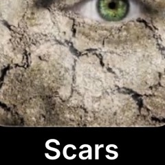 Scars