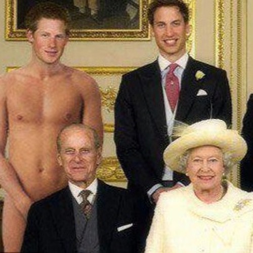 Prince Harry(william's bald)