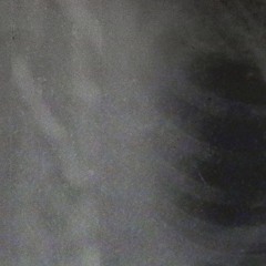 hole under the rib