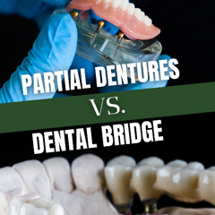 Dental Bridge vs. Partial Denture: Which Tooth Replacement Option Is Best?