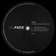 B2 - Cerec - Laguna
