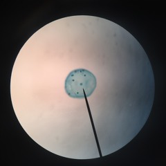 Membrane