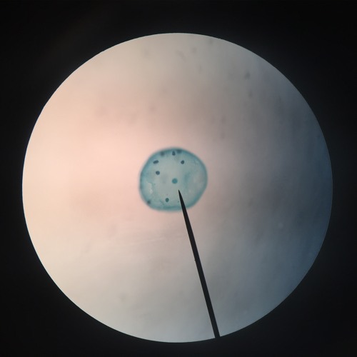 Membrane