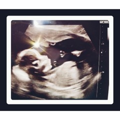 Cadallac Almightee-Sun=Son