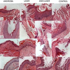 The Chromatographic Constitution of Andiroba Oil and its Healing Effects…