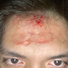 bellow prod. xanderr89