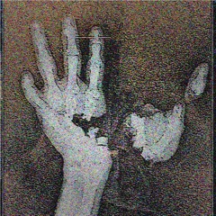 removing the last digit from my left pinky finger