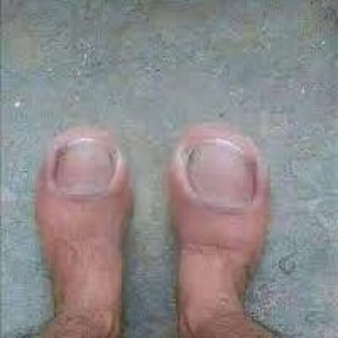 Stream Feet With 4 Toes by EternalDeath_000 | Listen online for free on ...