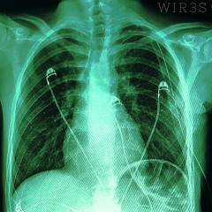 WIR3S (prod.DESPAIRINTOASHES)