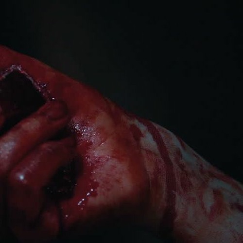 Open Wrists