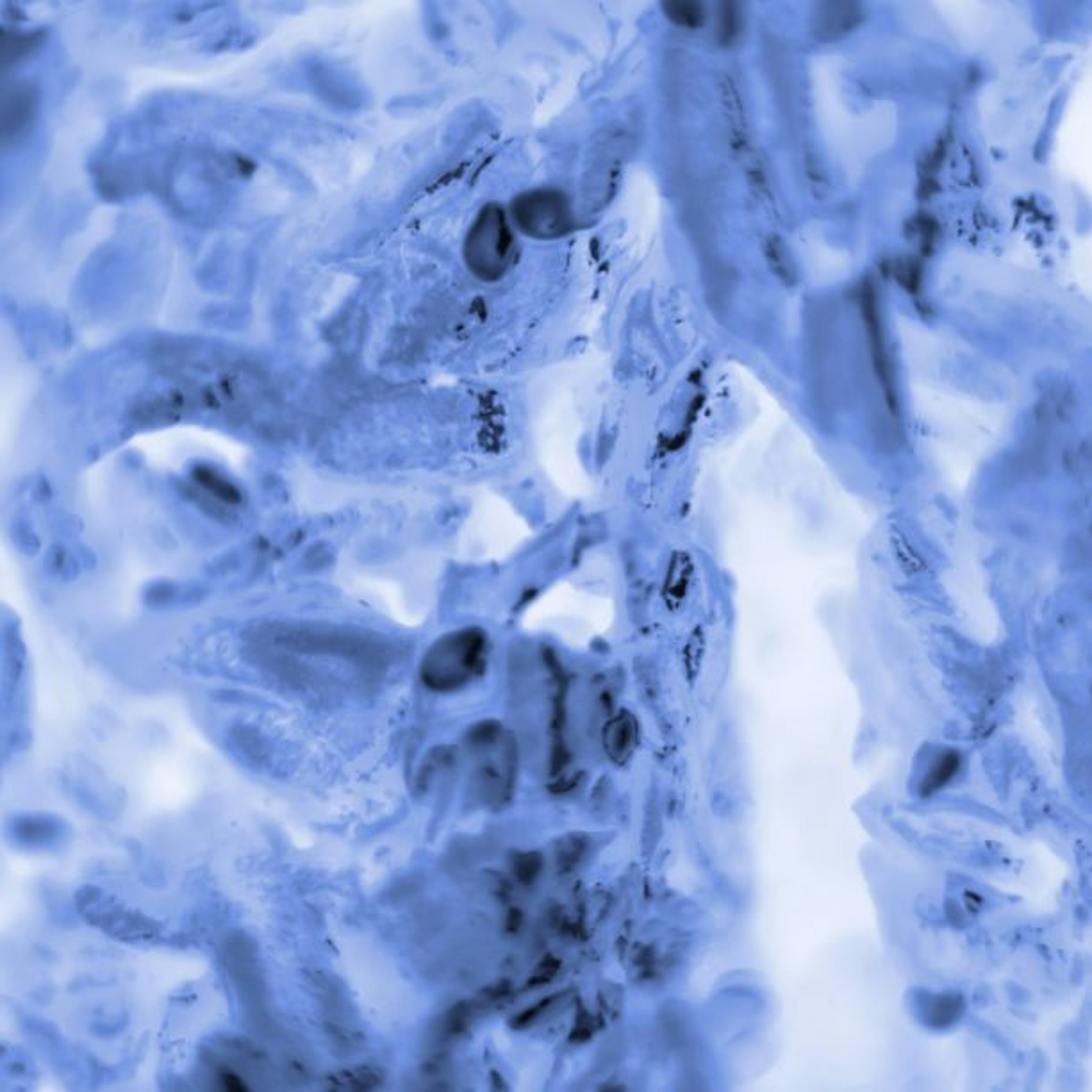 Oncotarget