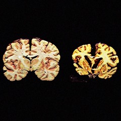 She forgives him and they embrace happily