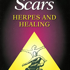 [Download] PDF 📔 Erasing Scars: Herpes and Healing by  Dr. James D. Okun MD &  Evang