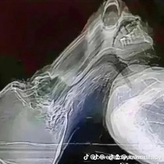 WSZYSTKO OD 2NP I KUKI