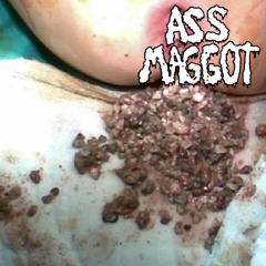 i shit tonsil stones