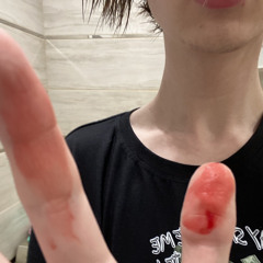 хестон брэйс думстейшайооо