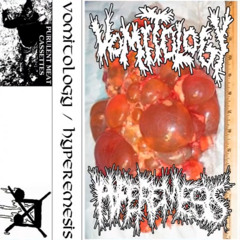 VOMITOLOGY-HYPEREMESIS SPLIT(VOMITOLOGY SIDE)