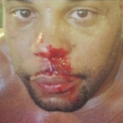 MC RD TRONCO DE ÁRVORE - SANGRAMENTO DE NARIZ KKKKKKKK