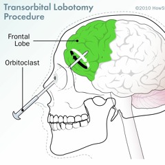 numbers on the screen (fried by fluoride cover)