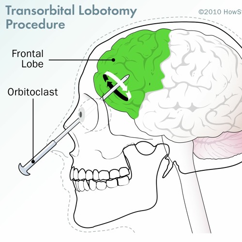 numbers on the screen (fried by fluoride cover)