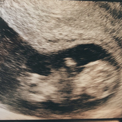 北風と太陽(prod.Kuzu Hirose)