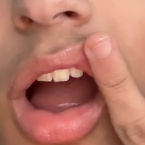 lipgloss - shriek remix