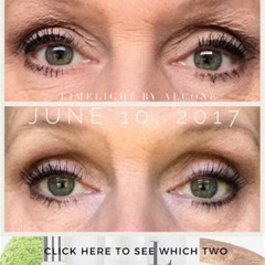 Best Eye Treatment For Crepey Eyelids Reviews